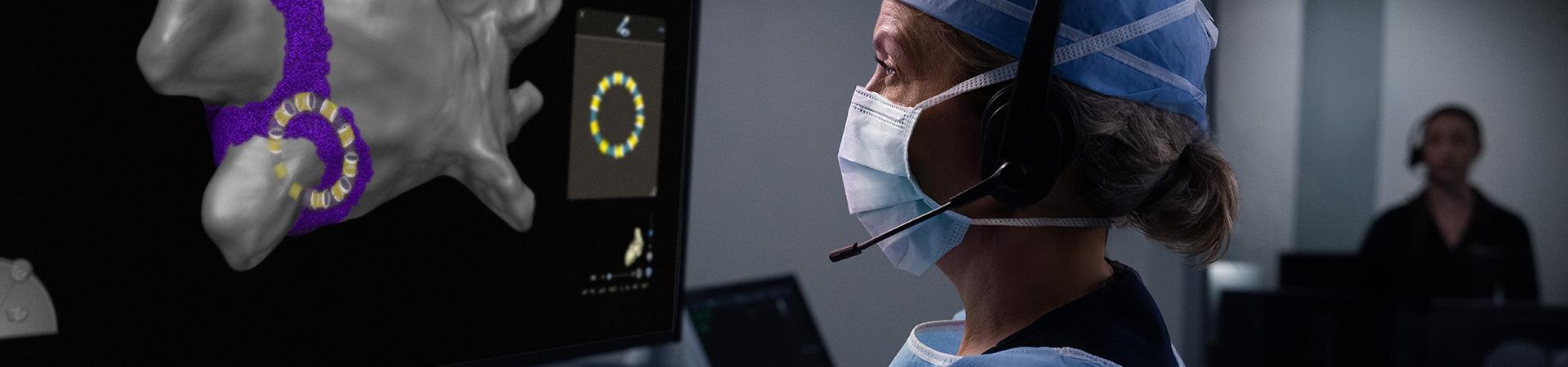 VARIPULSE Platform Pulsed Field Ablation Image