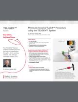 image from "Minimally Invasive VueLIF Procedure using the TELIGEN™ System - Richard Fessler, MD"