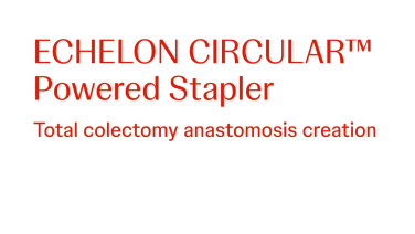 An Image From "Total Colectomy Using the ECHELON CIRCULAR™ Powered Stapler with Ron Landmann, MD"